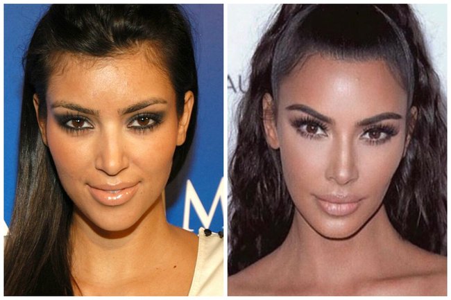 kim-kardashian-before-plastic-surgery.jpeg