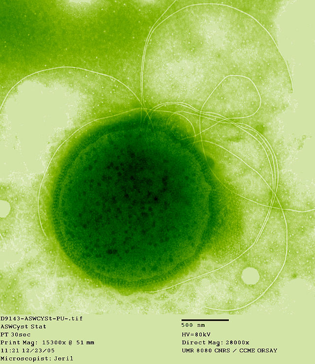 Thermococcus_gammatolerans.jpg