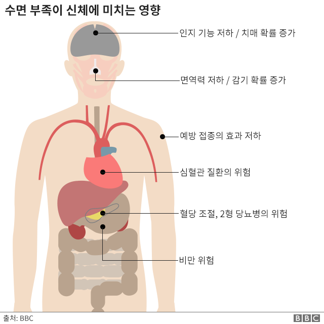 98546024_sleep_in_charts_body_v2_640_korean-nc.png
